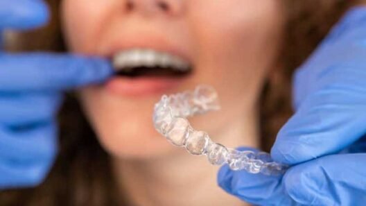 Common Misconceptions About Invisalign Treatment in Richmond