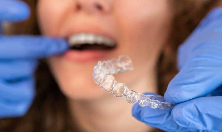 Common Misconceptions About Invisalign Treatment in Richmond