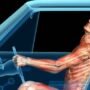 What to Know About Traumatic Brain Injuries After a Serious Truck Collision
