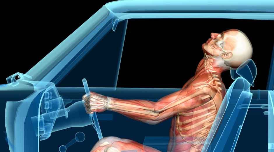 What to Know About Traumatic Brain Injuries After a Serious Truck Collision