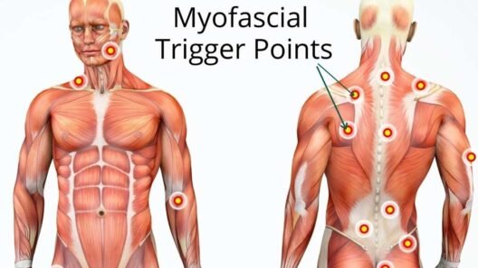 Understanding Your Body's Trigger Points and Their Effect on Movement