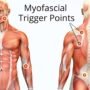 Understanding Your Body's Trigger Points and Their Effect on Movement